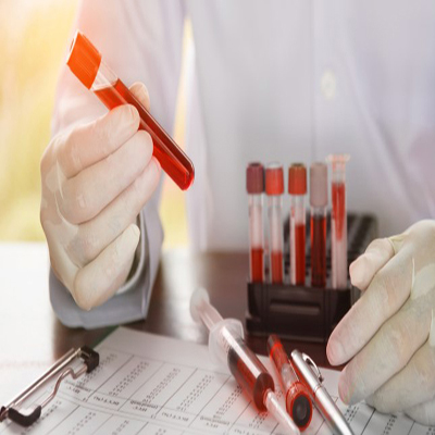 Scientist holding tube with blood sample making and test or research in clinical laboratory