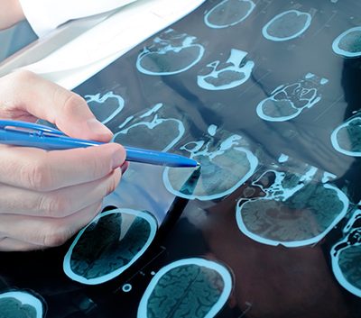 neurochirurgie1